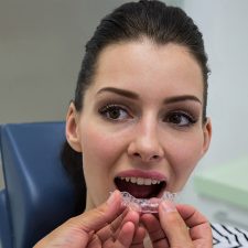 How Long Does Invisalign® Take? Factors That Impact Your Treatment Timeline