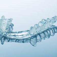 Maintaining Invisalign®: How to Keep Your Aligners Clean and Effective
